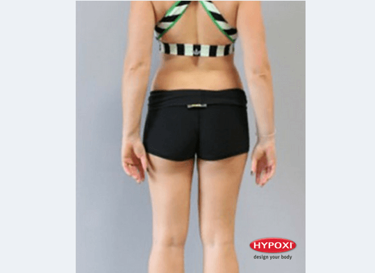 Hypoxi