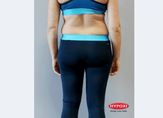 Hypoxi